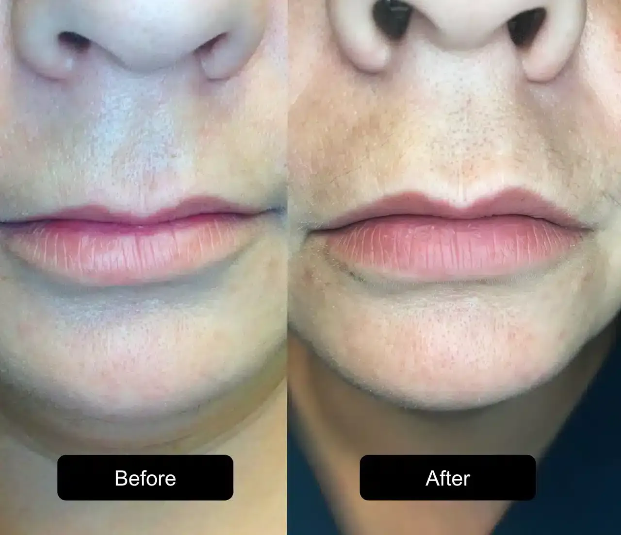 Before and after patient treatment result at Vita Sana Medical Center
