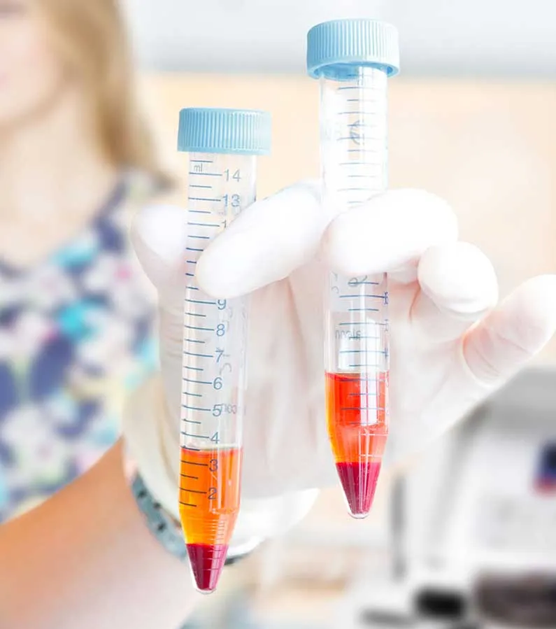 PRP-Regenerative-Injection-Therapy-4300-N-Miller-Rd-Suite-144-Scottsdale-AZ-85251