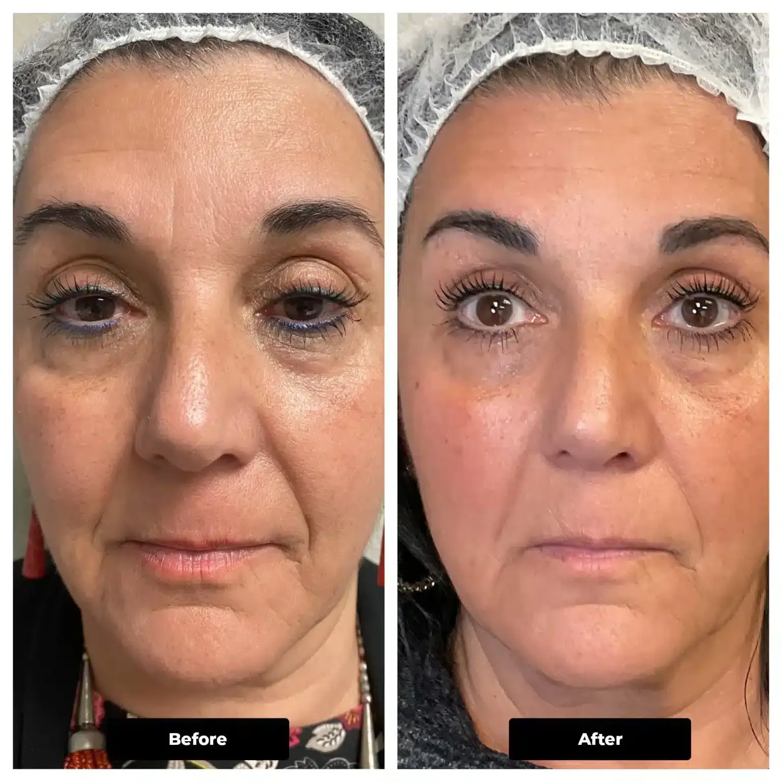Before and after patient treatment result at Vita Sana Medical Center