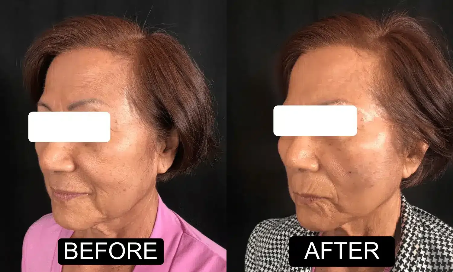 Before and after patient treatment result at Vita Sana Medical Center