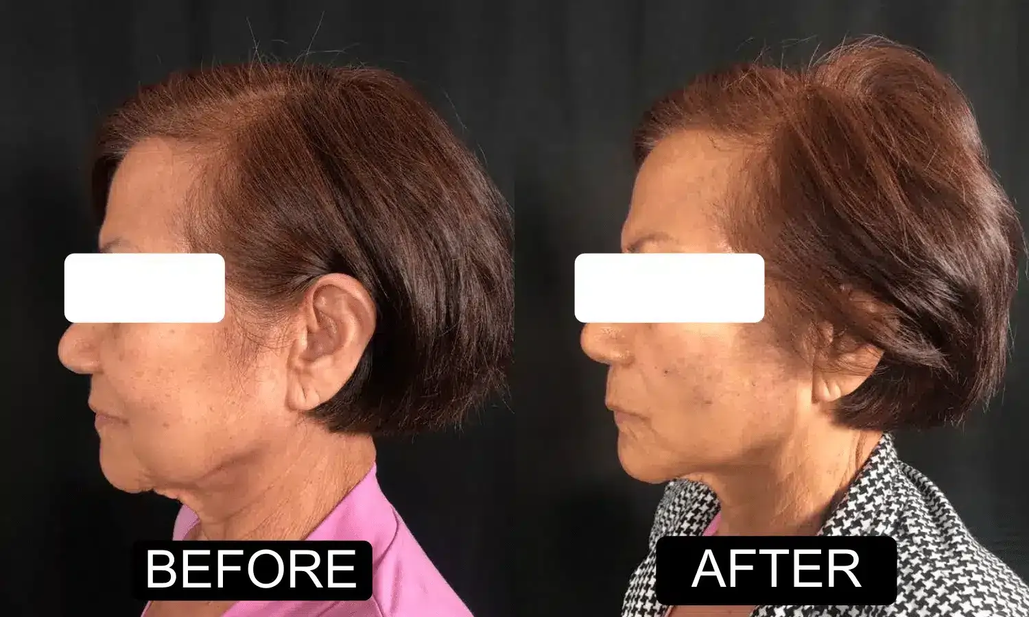 Before and after patient treatment result at Vita Sana Medical Center